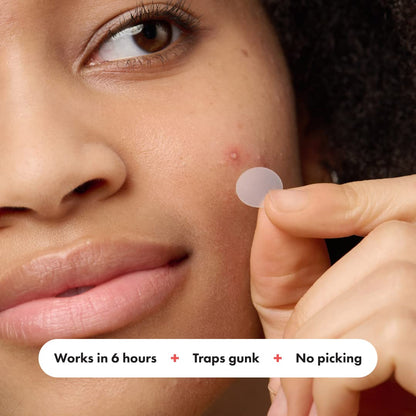 Mighty Patch™ Original Hydrocolloid Acne Patch